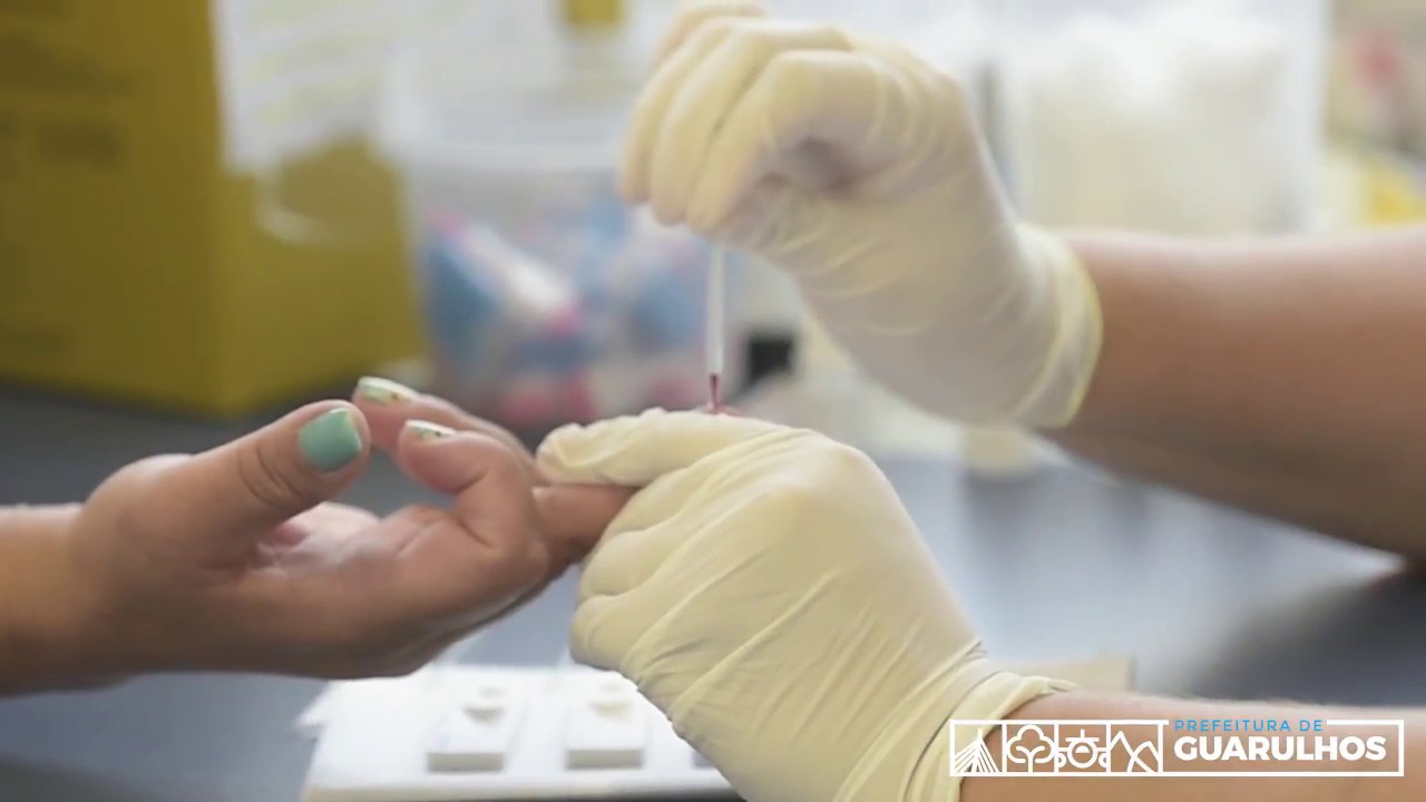 Saiba como funciona Centro de Testagem e Aconselhamento (CTA)