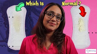 What&#39;s Up With My White Or Clear Vaginal Discharge? Is It Normal, Or Could It Be A Yeast Infection?