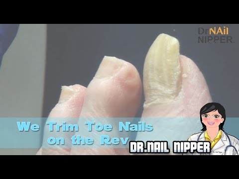 , title : 'We Trim Toe Nails on "The Rev".  Is Trimming Toenails Feel Good?'