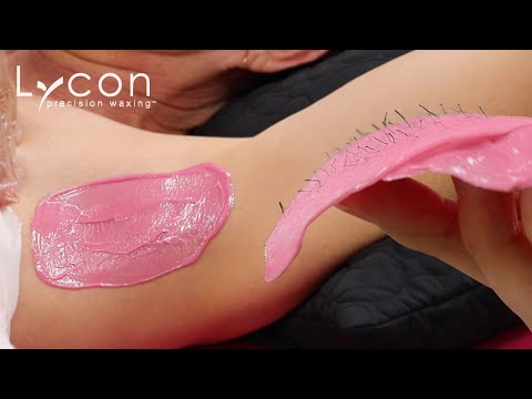 Voksing av armhule med LYCOdream Hybrid Hot Wax | Lycon Nordic