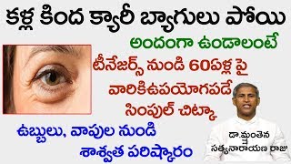 కళ్ల కింద ఉబ్బులు,వాపులు పోవాలంటే?|Best Way to Remove Eye Bags|Dr.Manthena Satyanarana|Good Health