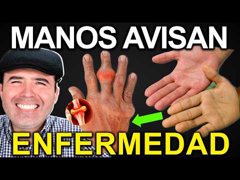 DETECT DISEASES IN 5 MINUTES WITHOUT DOCTORS - How to Read the Symptoms of Your Hands