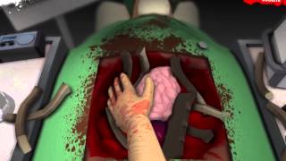 [Nut] Surgeon Simulator: I KILLED RL!!!