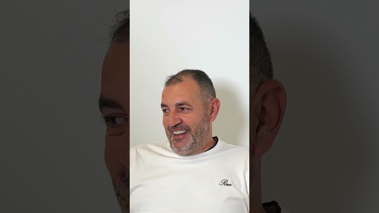 Iskustvo pacijenta iz dijaspore sa fiksnim zubima — video, ordinacija dr Radlovački