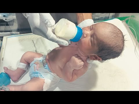 Low Sugar Baby First Feed | Newborn Hypoglycemia Management #neonatologist #nicu #babycare 
