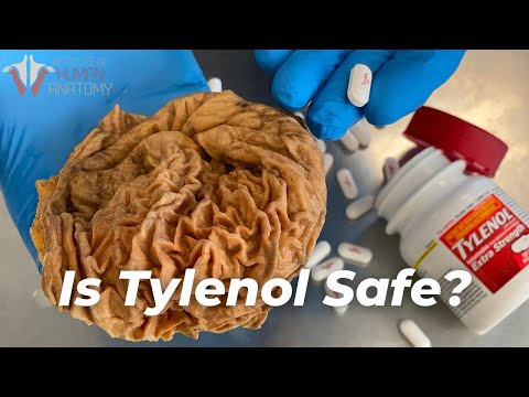 The Tylenol Mistake: Are You Taking Too Much?