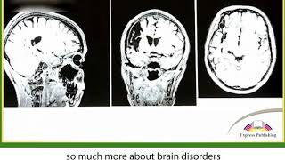 Action 11. Module 3. Brain Gain - The Future of Brain Technology
