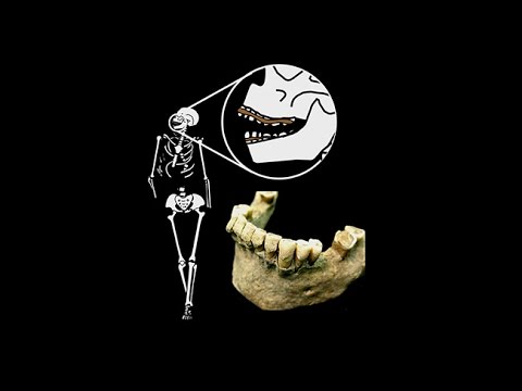 CARTA: Ancient DNA and Human Evolution – Prehistoric Human Biology as Inferred from Dental Calculus