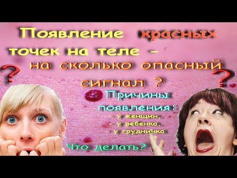 Отбеливание кожи лимоном отзыв Маска для лица с пигментными пятнами с глиной