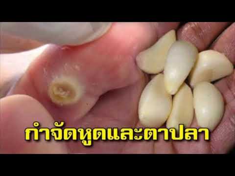 ราคาวิดีโอม้าเชื้อโรค หมายความว่าราคาแรง