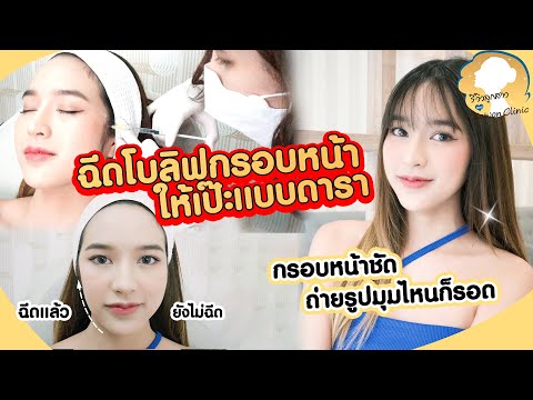 เมโสแฟต ยี่ห้อไหนดี