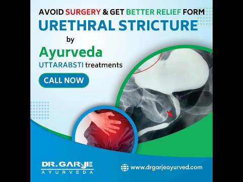  Panchakarma Patient Testimonial - Review 22