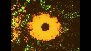 A Rotten Sun - Anthrodynia