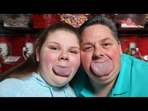 Guinness World Record: Father and Daughter Have World's Widest Tongues