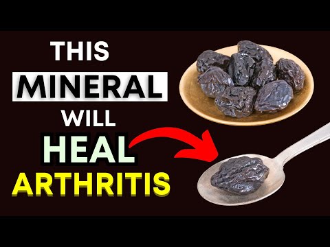 Top 3 Minerals Every Arthritis Sufferer Needs to Know (Natural Pain & Inflammation Relief!