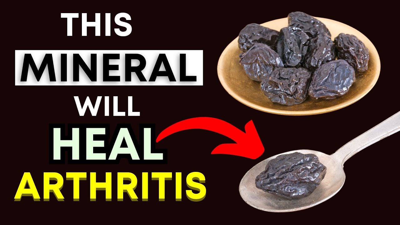 Top 3 Minerals Every Arthritis Sufferer Needs to Know (Natural Pain & Inflammation Relief!