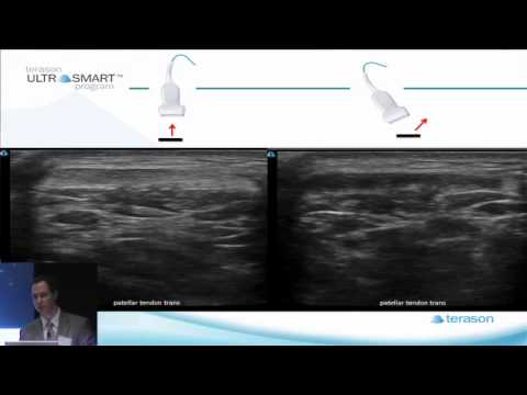 Terason's MSK Ultrasound Basics with Dr. Visco: Part 6 of 8