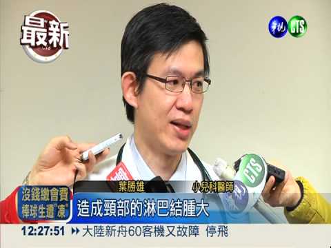 發燒.喉嚨痛 當心A族鏈球菌作怪