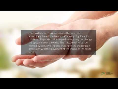 Scaphoid Fractures - Symptoms and Treatment