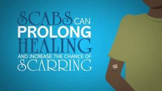 Wound Care Myth #29: Scabs Are a Sign of Healing