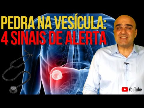 4 sinais e sintomas de alerta para pedra na vesícula