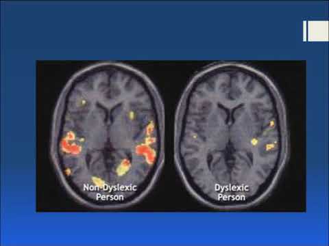 Dyslexia 1