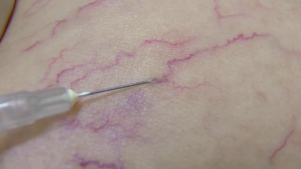 Luiz Carlos Furtat Jr-12