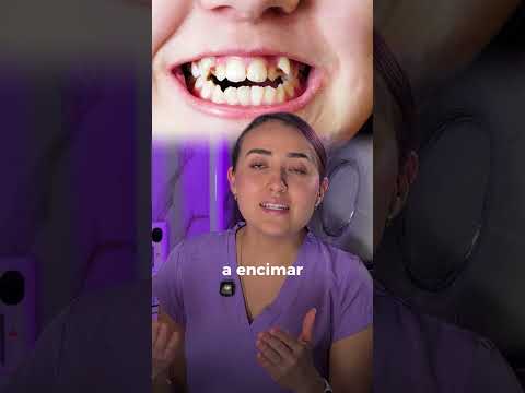 Video 6