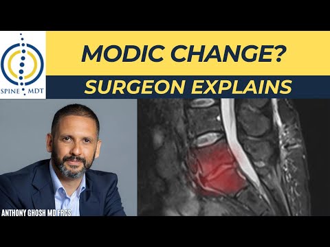What Are Modic Changes on MRI? Spine Surgeon Explains
