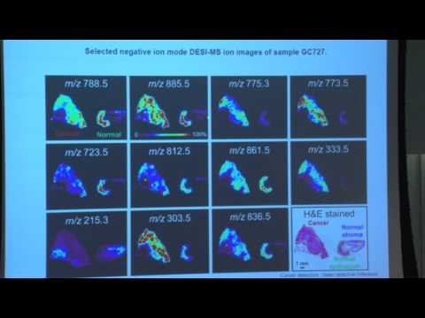 The Lasso  An Application to Cancer Detection and Some New Tools for Selective Inference