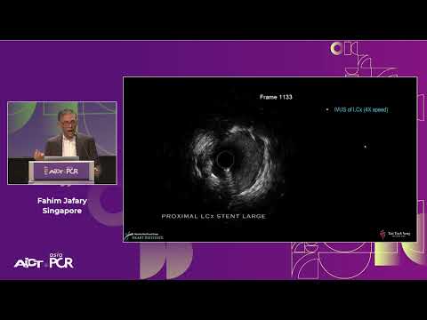 The importance of SEE-PREP-TREAT in left main bifurcation - AICT-AsiaPCR 2023