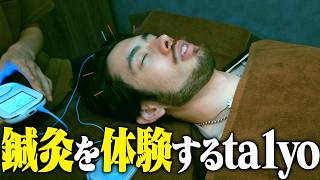 気になっていた「鍼灸」をついに体験するta1yo