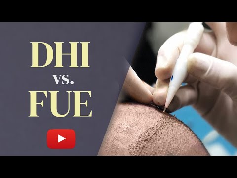 DHI vs FUE Hair Transplant: Which is the BEST Choice...