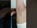 How To Underarms Wax Wex Underarmswex