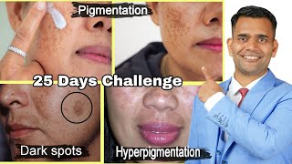 25 Days Challenge Get Rid Of Pigmentation, melasma Naturally