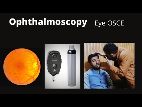 Ophthalmoscopy | OSCE Guid