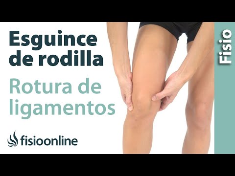 Rodilla esquema de conjunto en el cuadro Osteomielitis enfermedad de las articulaciones