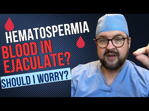 Hematospermia: Blood in the Ejaculate! Should I worry? Dr Kent DeLay- Urologist South Carolina