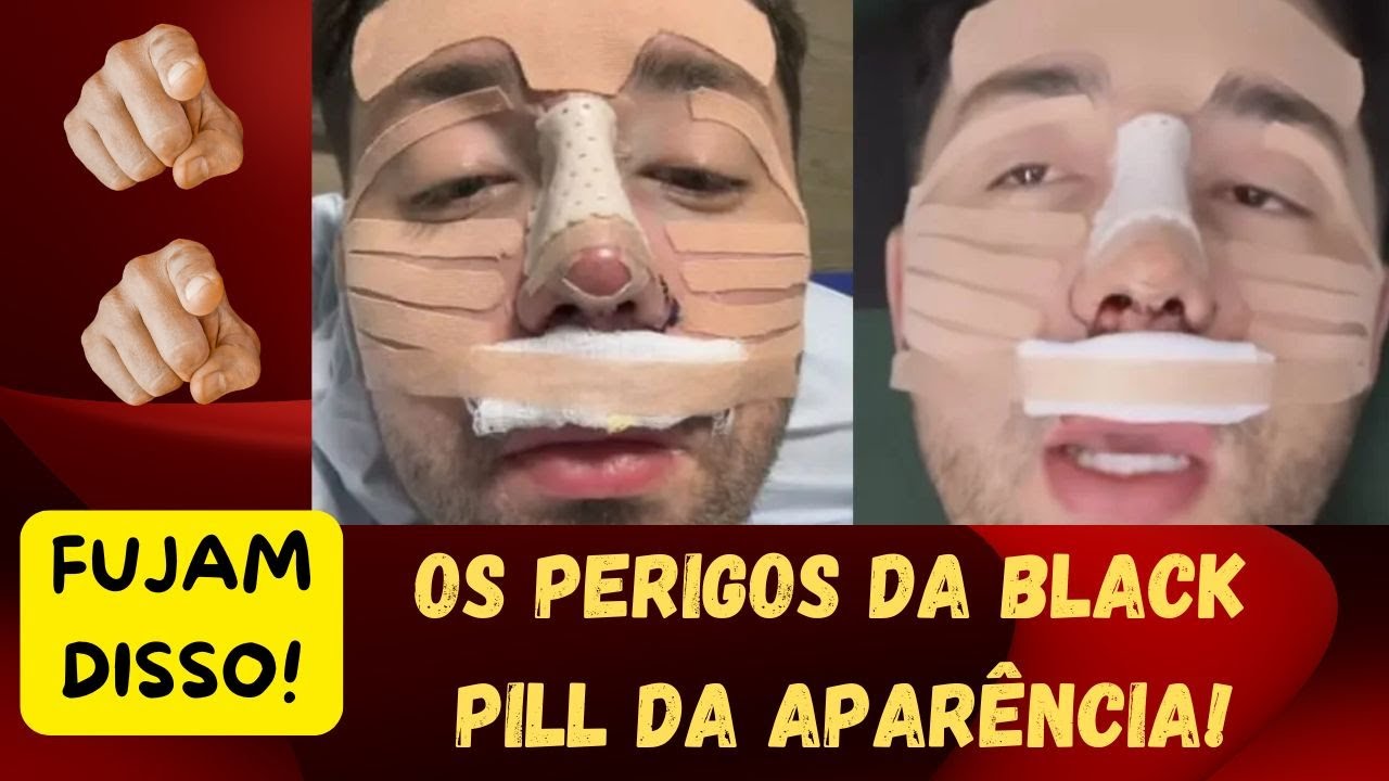 O PERIGOSO TEMA DA "BLACKPILL" DA APARÊNCIA! UMA REFLEXÃO DEFINITIVA PARA HOMENS AFASTAREM-SE DISSO!