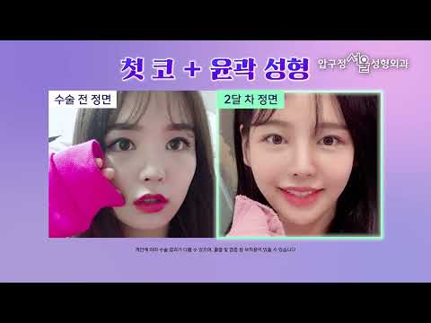 2025년도에도 HOT한 코성형 후기.zip 🍀 압구정서울성형외과