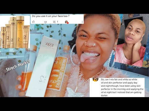 FAIR & WHITE || Does FW Cause StretchMarks? || Answering Questions About Fair & White + Tips