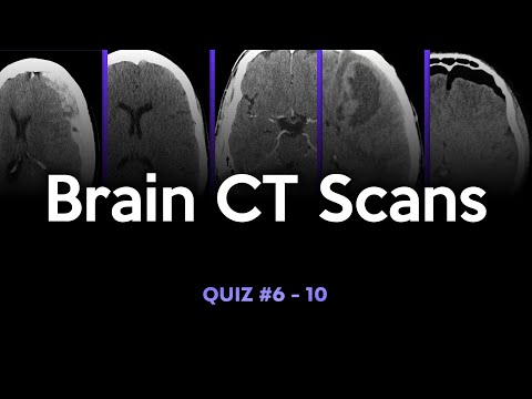 Brain CT Scans: Quiz #6 - 10