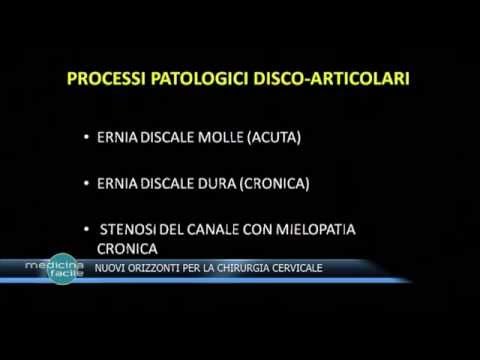 Destra dellanca artrosi congiunta dei 2 gradi Dopo accovacciata fianchi doloranti