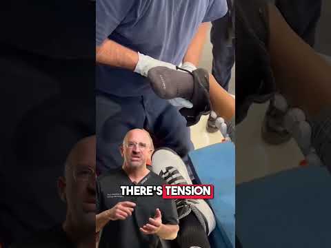 Ankle DISLOCATION + FRACTURE: Suffered an ankle injury? 👇 #shorts