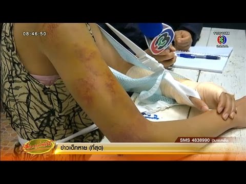 คลิกเพื่อดูคลิปวิดีโอ