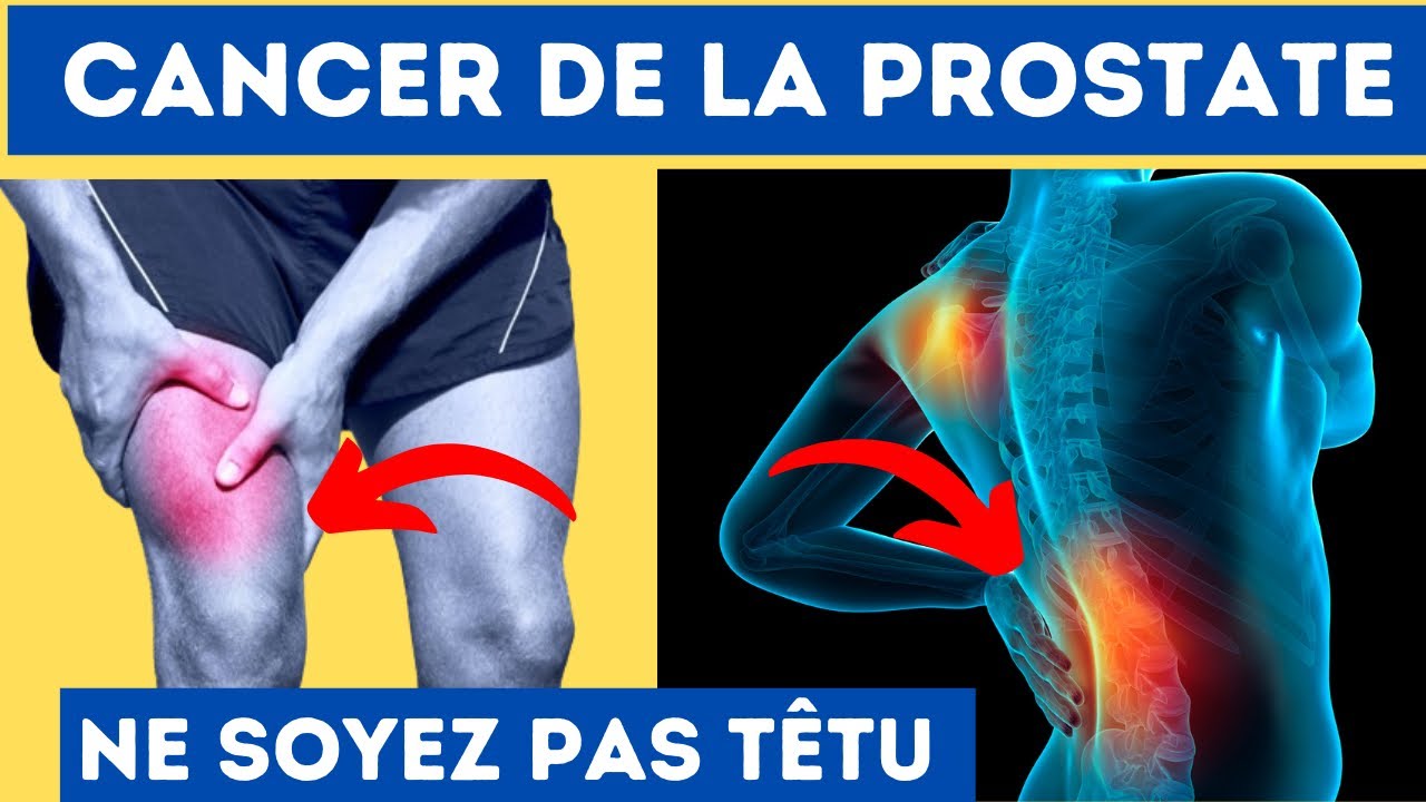 10 Signes Avant-Coureurs Du Cancer De La Prostate - Ne Soyez Pas têtu !