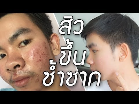 ที่จะติดต่อในอำนาจที่น่าสงสาร ยาพื้นบ้านเพื่อเพิ่มสมาชิก