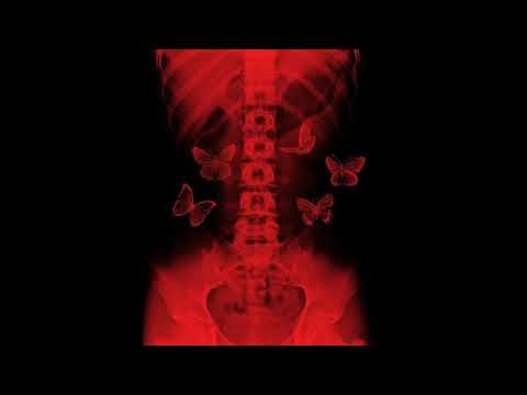 Aya Nakamura x Hamza Type Beat - Blessé (prod. Juyo)