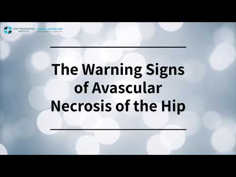 The Warning Signs of Avascular Necrosis of the Hip