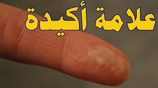 هل الافرازات البيضاء قبل الدورة من علامات الحمل